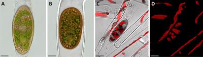 Zygospores of the green alga Spirogyra: new insights from structural and chemical imaging